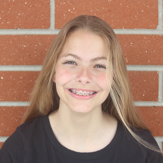 Lily Archbold (Ensemble, Marymount 1) head shot