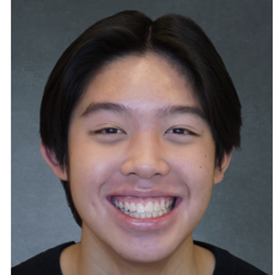 Aidan Bounngaseng head shot